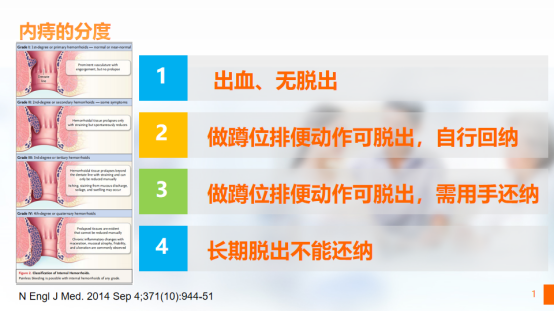 王業(yè)皇：痔瘡、便血怎么辦，正規(guī)醫(yī)院治療其實(shí)很簡單(圖1)